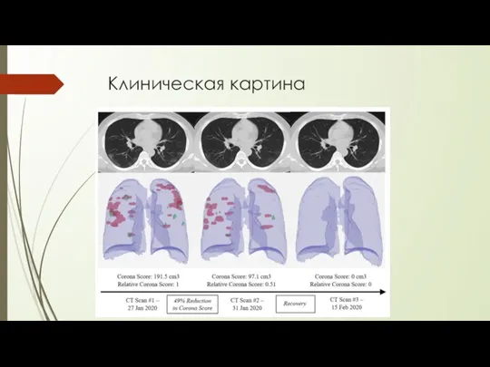 Клиническая картина