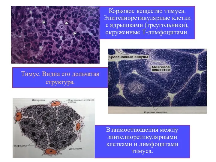 Тимус. Видна его дольчатая структура. Корковое вещество тимуса. Эпителиоретикулярные клетки с ядрышками