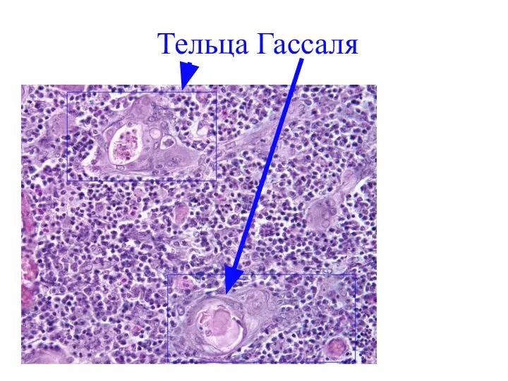 Тельца Гассаля