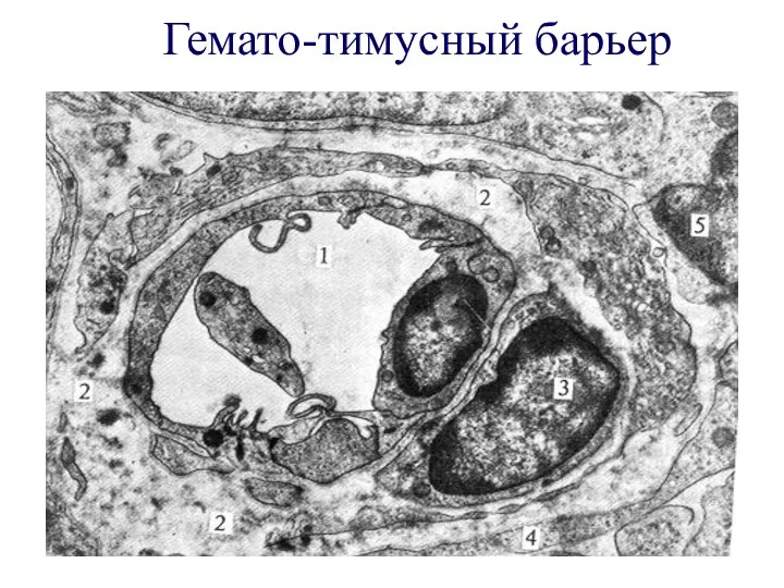 Гемато-тимусный барьер