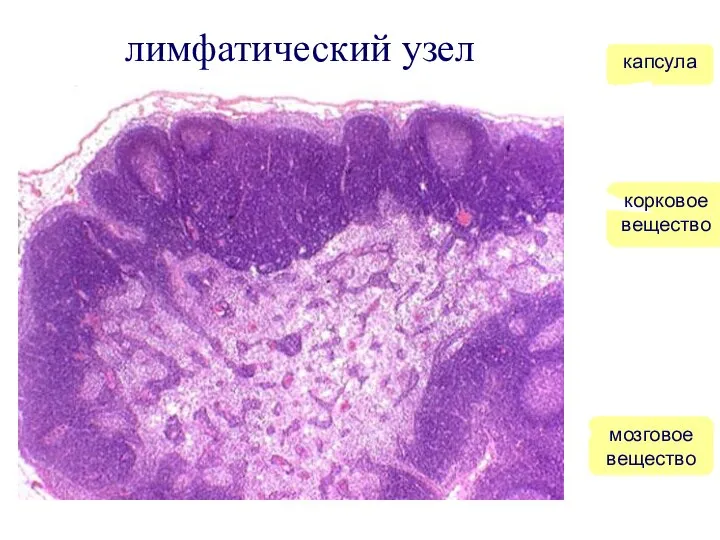 лимфатический узел капсула корковое вещество мозговое вещество