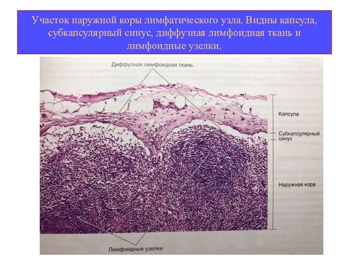 Участок наружной коры лимфатического узла. Видны капсула, субкапсулярный синус, диффузная лимфоидная ткань и лимфоидные узелки.