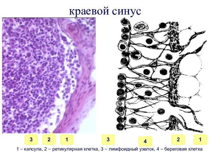 краевой синус 1 4 2 1 3 2 1 – капсула, 2