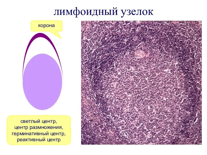 лимфоидный узелок светлый центр, центр размножения, герминативный центр, реактивный центр корона корона