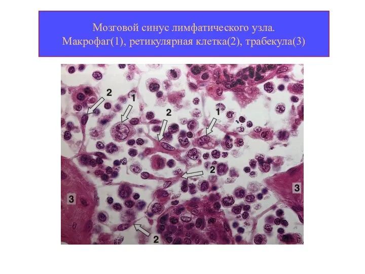 Мозговой синус лимфатического узла. Макрофаг(1), ретикулярная клетка(2), трабекула(3)