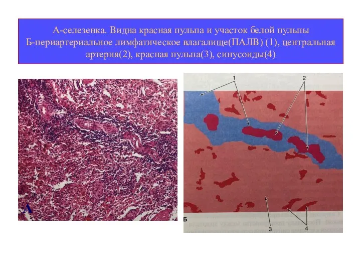 А-селезенка. Видна красная пульпа и участок белой пульпы Б-периартериальное лимфатическое влагалище(ПАЛВ) (1),