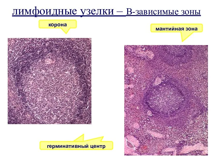 лимфоидные узелки – В-зависимые зоны корона мантийная зона 1 герминативный центр