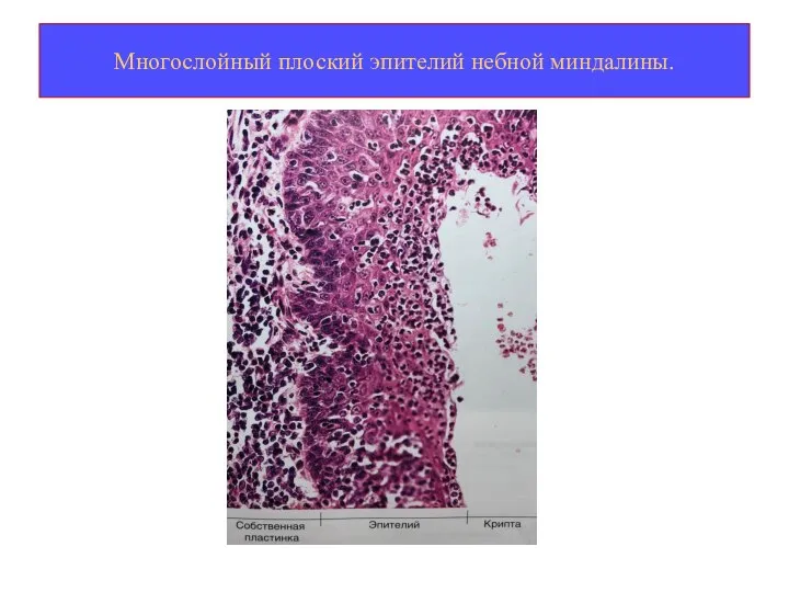 Многослойный плоский эпителий небной миндалины.