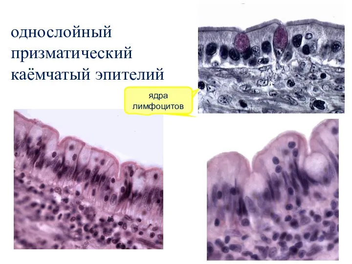 лимфоидные узелки лимфоидные узелки однослойный призматический каёмчатый эпителий ядра лимфоцитов