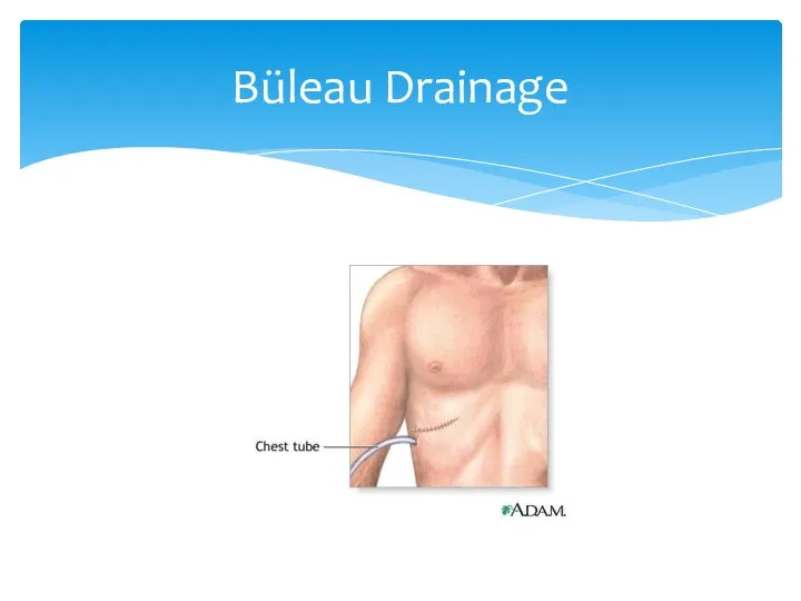 Büleau Drainage