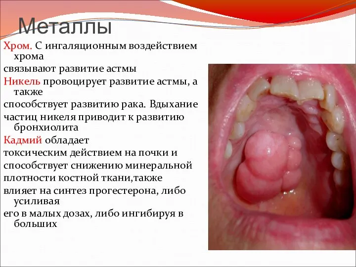 Металлы Хром. С ингаляционным воздействием хрома связывают развитие астмы Никель провоцирует развитие