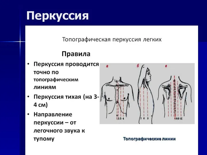 Перкуссия