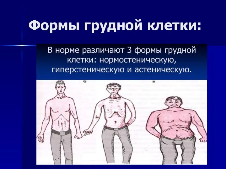 Формы грудной клетки: