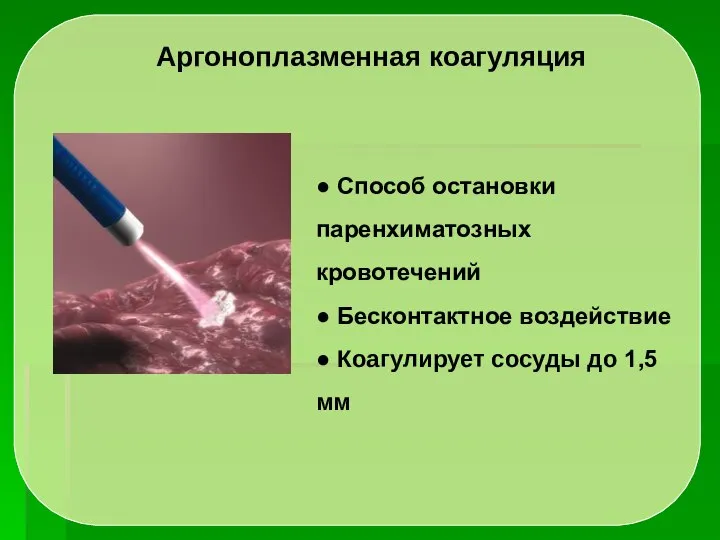 Аргоноплазменная коагуляция ● Способ остановки паренхиматозных кровотечений ● Бесконтактное воздействие ● Коагулирует сосуды до 1,5 мм