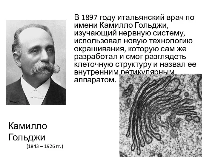 В 1897 году итальянский врач по имени Камилло Гольджи, изучающий нервную систему,