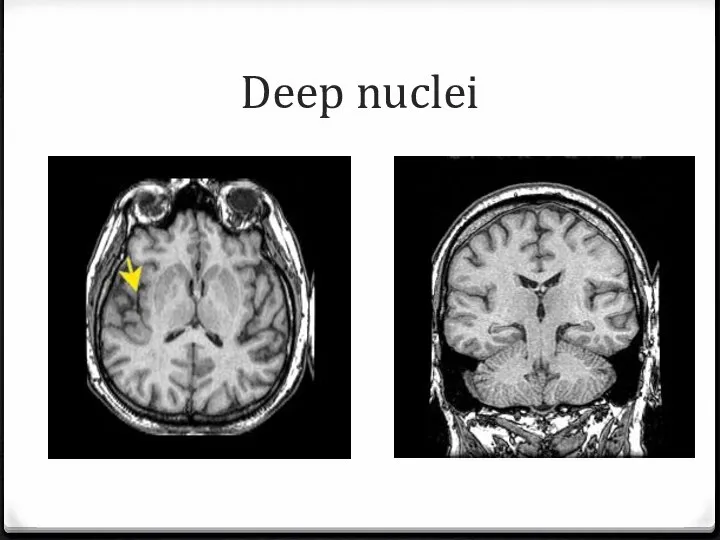 Deep nuclei