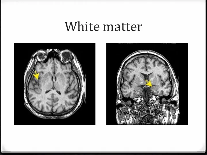 White matter