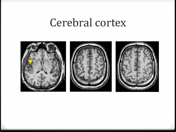 Cerebral cortex