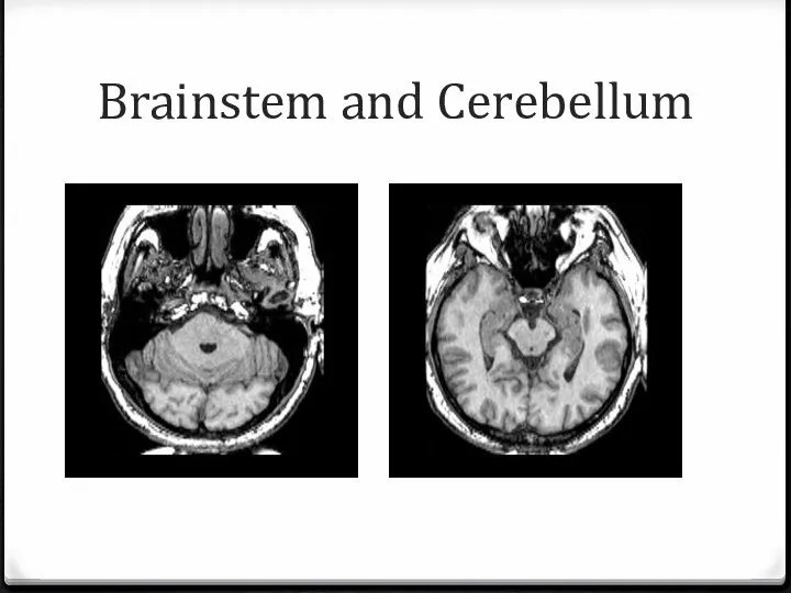 Brainstem and Cerebellum