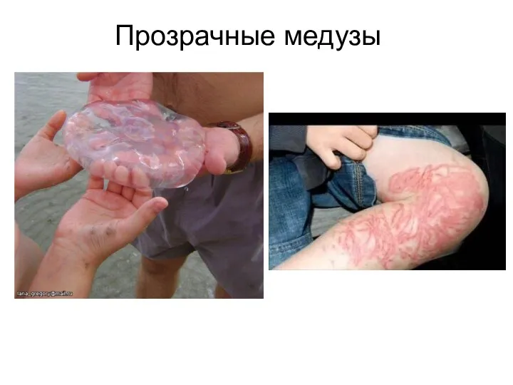 Прозрачные медузы