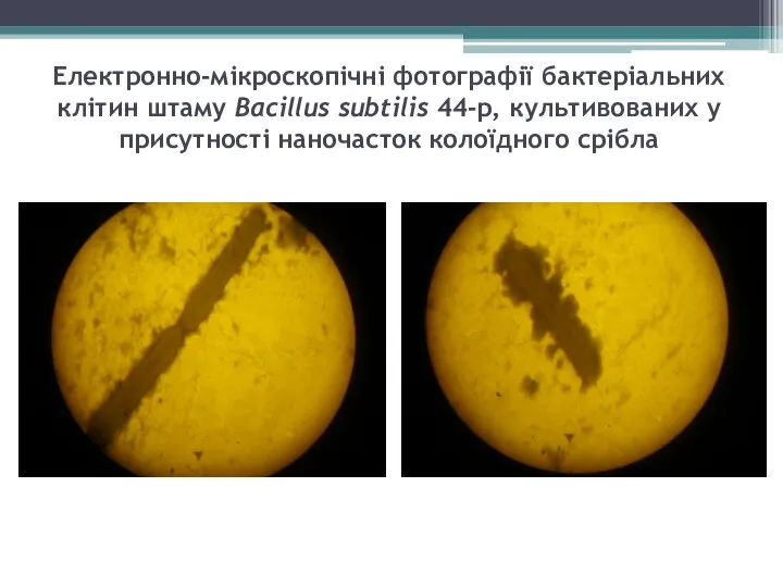 Електронно-мікроскопічні фотографії бактеріальних клітин штаму Bacillus subtilis 44-р, культивованих у присутності наночасток колоїдного срібла