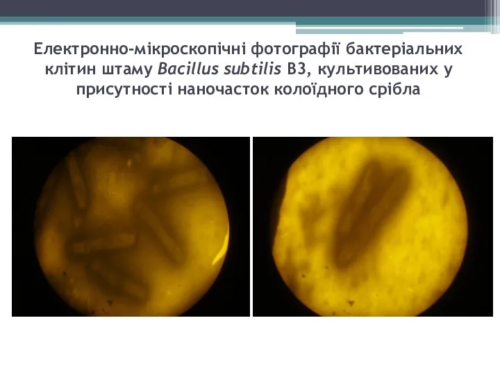 Електронно-мікроскопічні фотографії бактеріальних клітин штаму Bacillus subtilis В3, культивованих у присутності наночасток колоїдного срібла