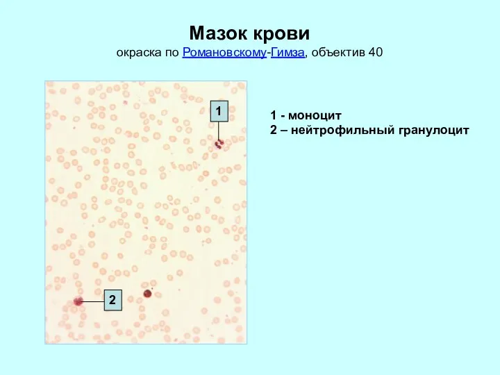 Мазок крови окраска по Романовскому-Гимза, объектив 40 1 - моноцит 2 – нейтрофильный гранулоцит 1 2