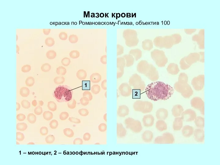 Мазок крови окраска по Романовскому-Гимза, объектив 100 1 1 – моноцит, 2 – базоофильный гранулоцит 2