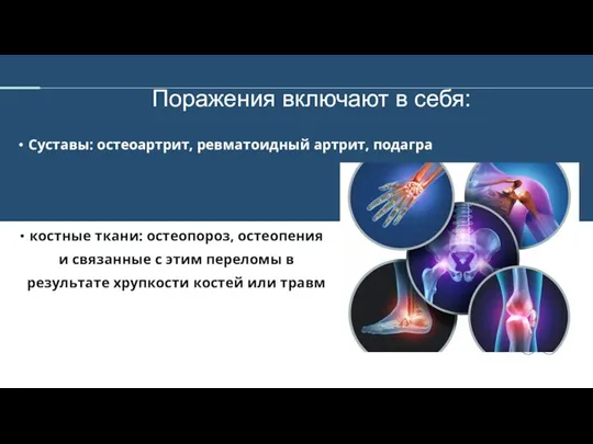 Поражения включают в себя: Суставы: остеоартрит, ревматоидный артрит, подагра костные ткани: остеопороз,