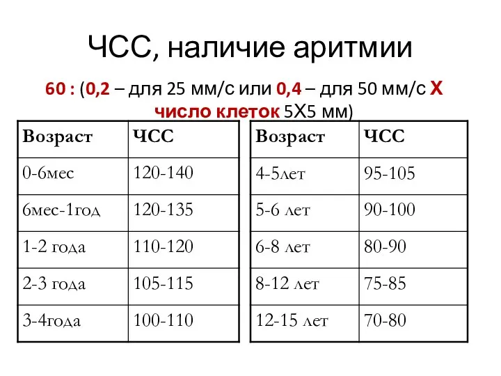 ЧСС, наличие аритмии 60 : (0,2 – для 25 мм/с или 0,4