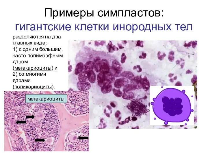 Примеры симпластов: гигантские клетки инородных тел мегакариоциты разделяются на два главных вида: