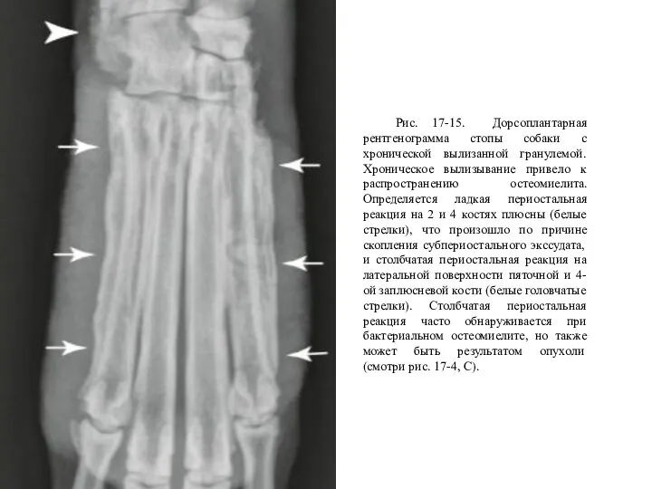 Рис. 17-15. Дорсоплантарная рентгенограмма стопы собаки с хронической вылизанной гранулемой. Хроническое вылизывание