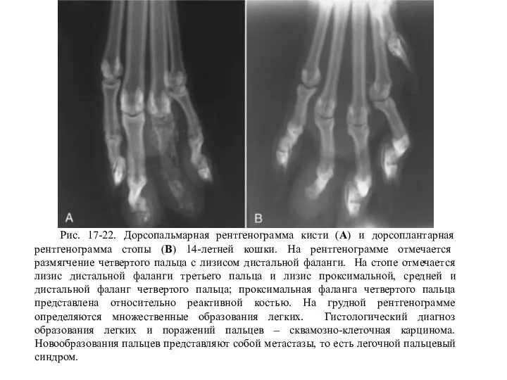 Рис. 17-22. Дорсопальмарная рентгенограмма кисти (А) и дорсоплантарная рентгенограмма стопы (В) 14-летней