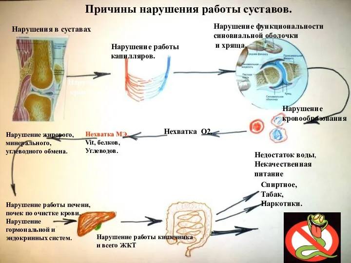 Причины нарушения работы суставов. Нарушения в суставах Нарушение кровоснабжения Нарушение работы капилляров.