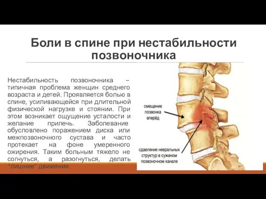 Боли в спине при нестабильности позвоночника Нестабильность позвоночника – типичная проблема женщин