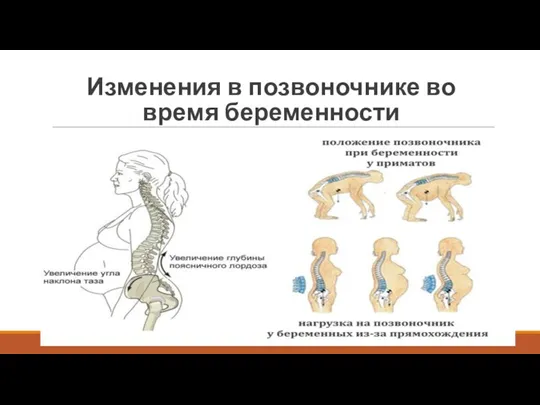 Изменения в позвоночнике во время беременности