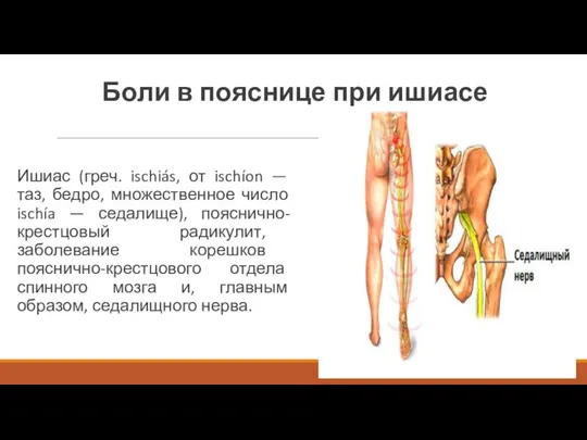 Боли в пояснице при ишиасе Ишиас (греч. ischiás, от ischíon — таз,