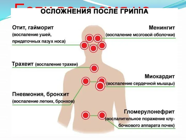 Если во время не начать лечиться могут возникнуть серьезные осложнения!!!!!