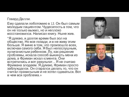 Говард Далли. Ему сделали лоботомию в 12. Он был самым молодым пациентом.