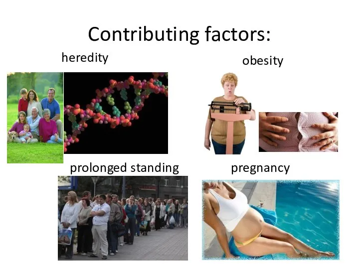Contributing factors: heredity obesity prolonged standing pregnancy