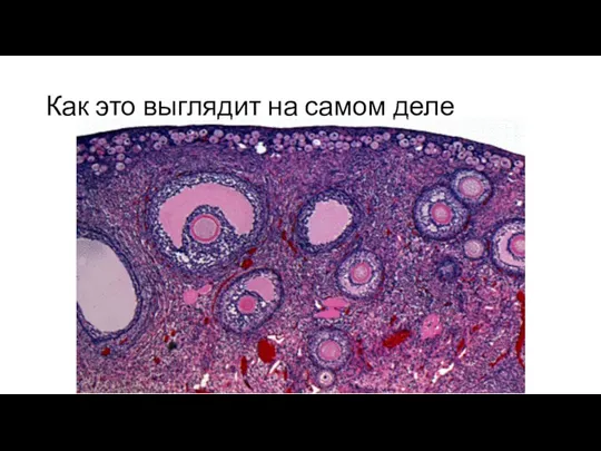 Как это выглядит на самом деле