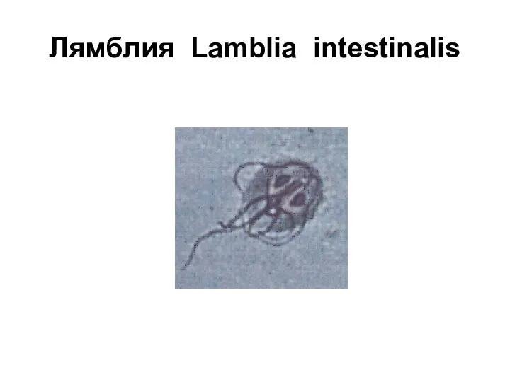 Лямблия Lamblia intestinalis