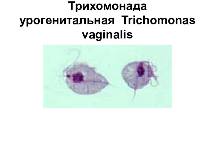 Трихомонада урогенитальная Trichomonas vaginalis