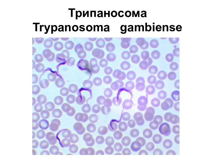 Трипаносома Trypanosoma gambiense