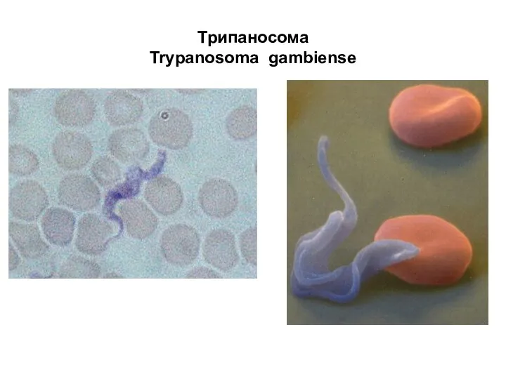 Трипаносома Trypanosoma gambiense