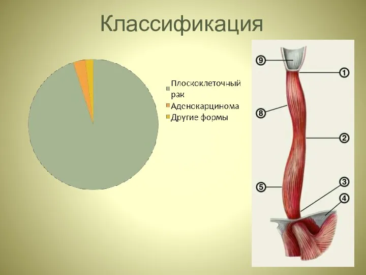 Классификация