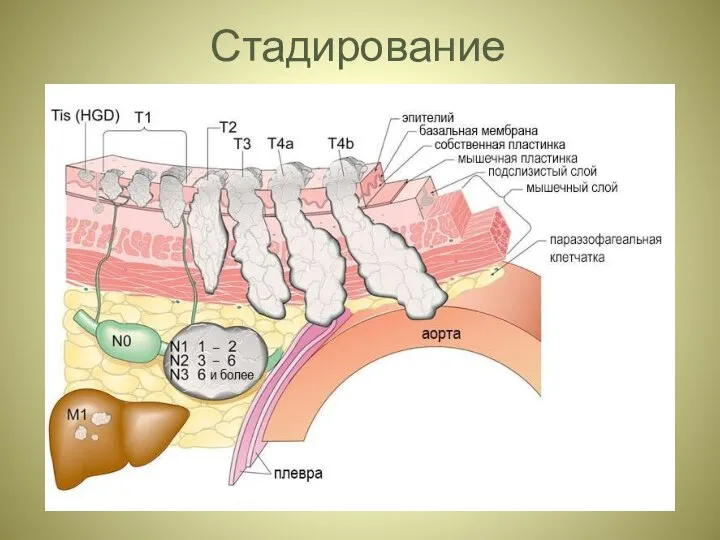 Стадирование