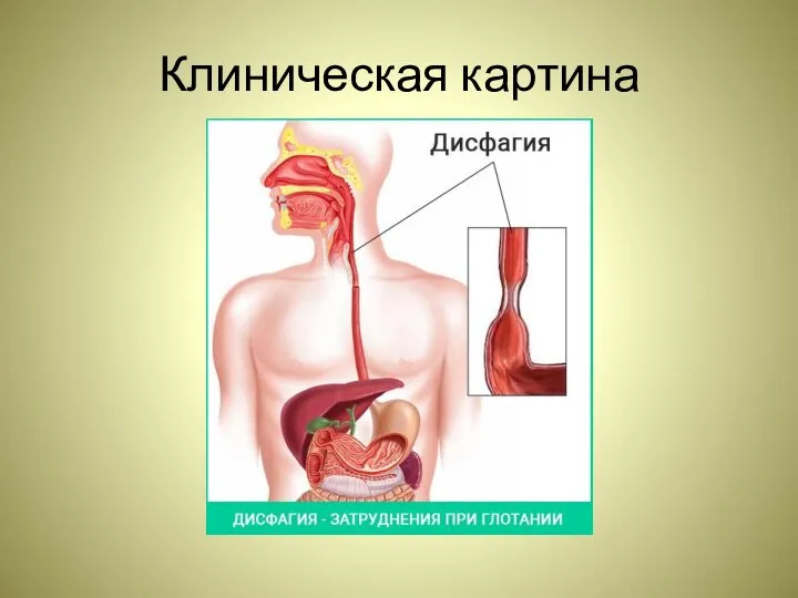 Клиническая картина