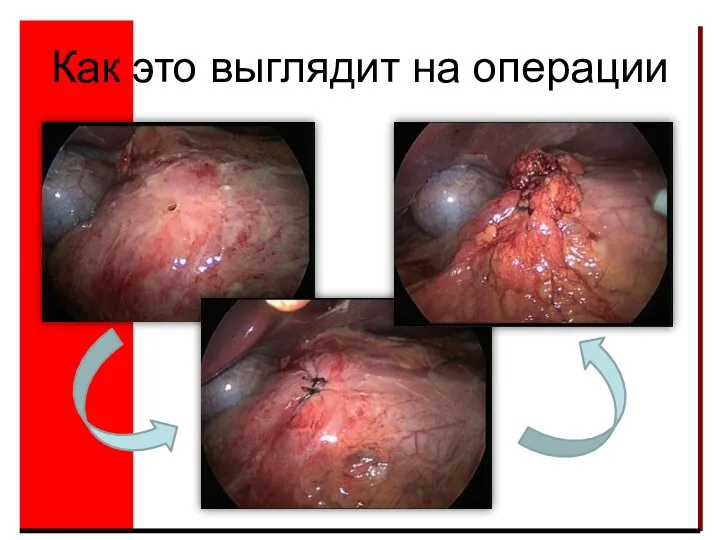 Как это выглядит на операции