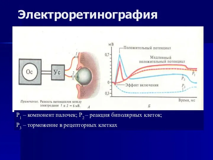 Электроретинография Р1 – компонент палочек; Р2 – реакция биполярных клеток; Р3 – торможение в рецепторных клетках